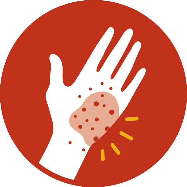 Allergy Skin File Transparent PNG Image