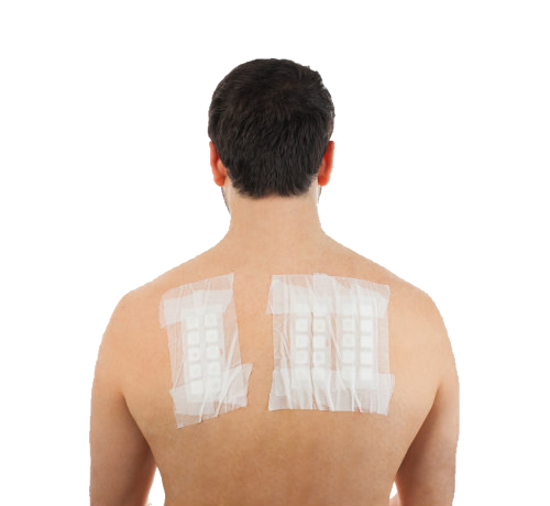 Allergy Skin Transparent PNG Image