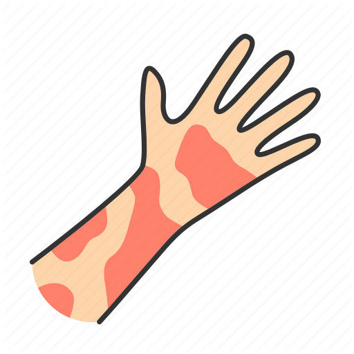 Allergy Skin Transparent PNG Image