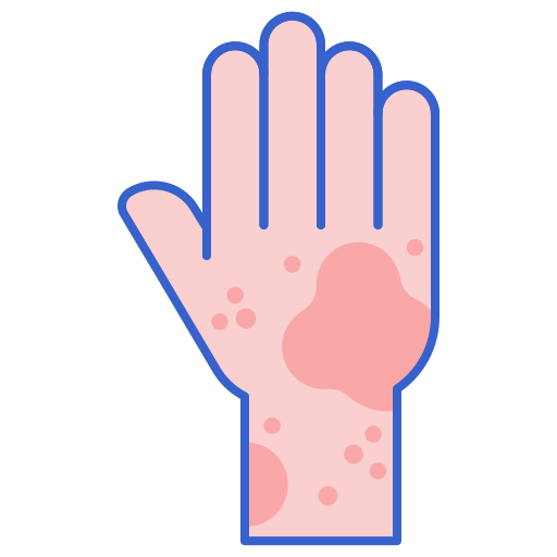 Allergy Skin Transparent PNG Image