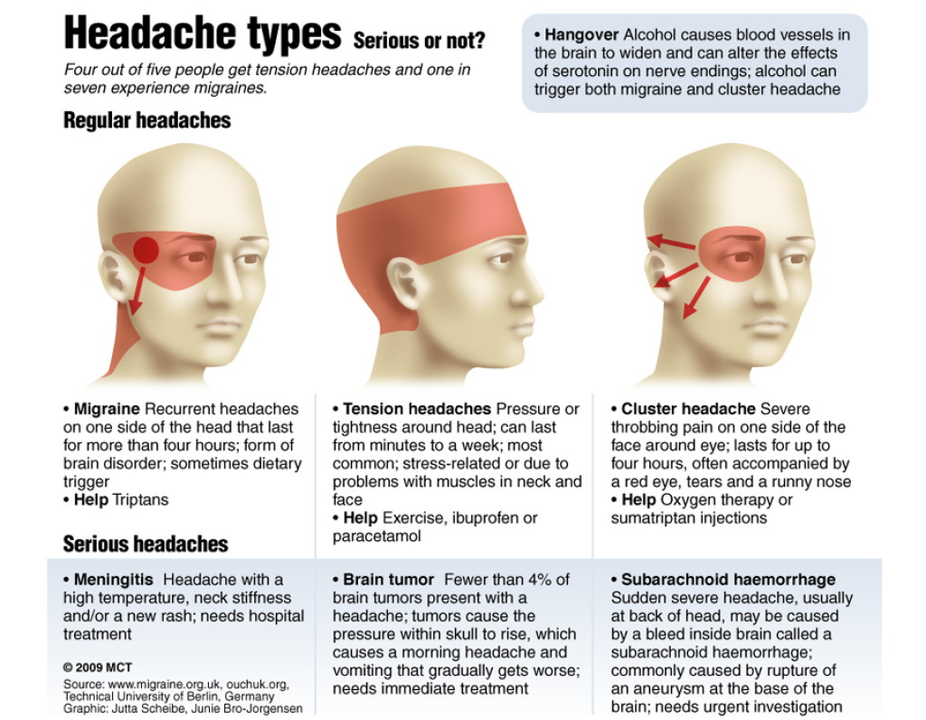 Ache Head Face Eyewear Headache Transparent PNG Image