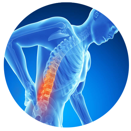 Back Pain Transparent PNG Image
