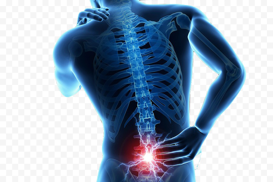 Back Pain Transparent PNG Image