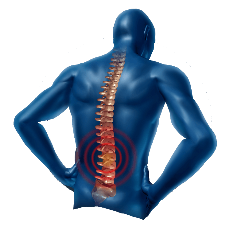 Back Pain Transparent PNG Image
