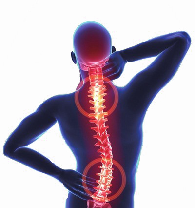 Pain In The Neck Transparent PNG Image