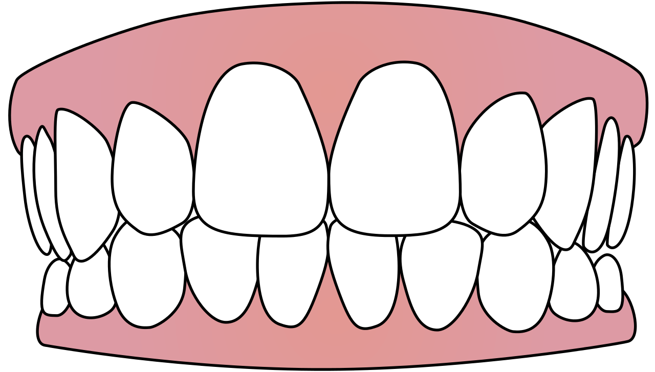 Clean Tooth Transparent PNG Image