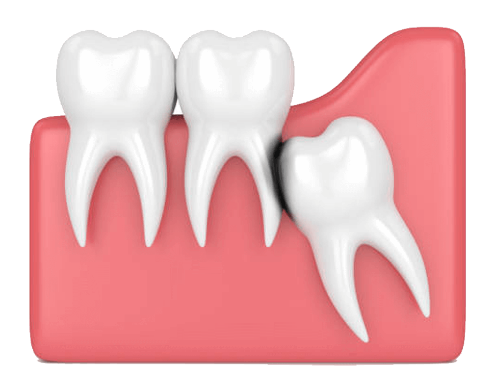 Crying Tooth Transparent PNG Image