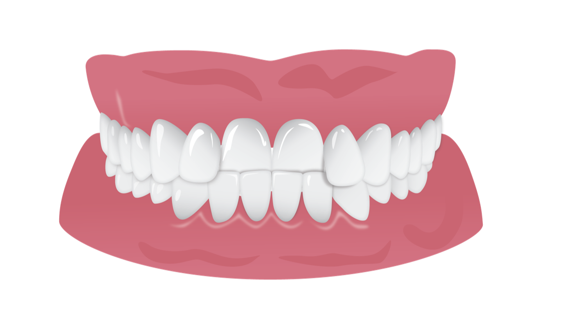 Healthy Tooth Transparent PNG Image