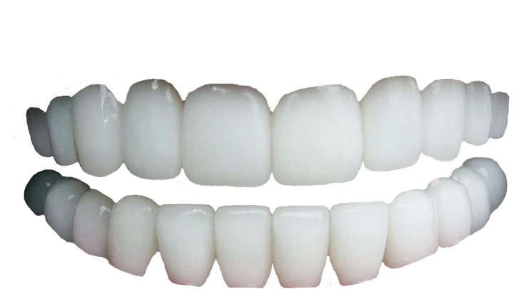 White Tooth Transparent PNG Image